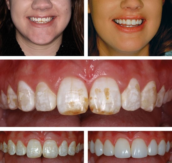 41415_2013_Article_BFsjbdj20131045_Fig1_HTML